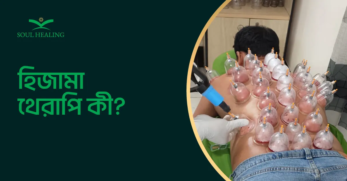 হিজামা থেরাপি কী?