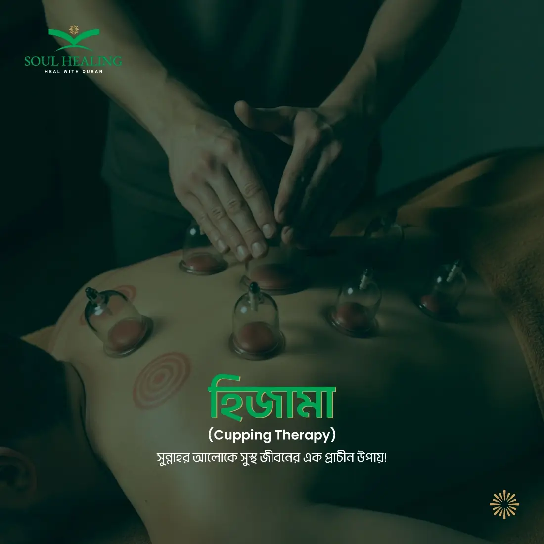 হিজামা